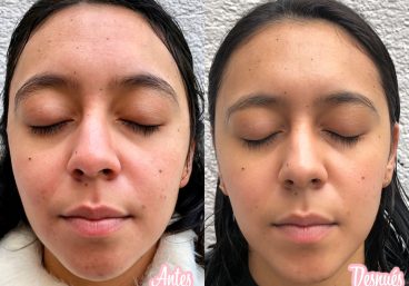 beneficios-de-la-vitamina-c-1-1440x1080